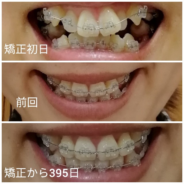 f:id:miichanmama5:20191020163646j:image f:id:miichanmama5:20191020163646j:image