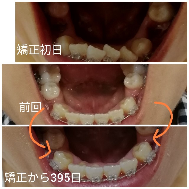 f:id:miichanmama5:20191020163953j:image f:id:miichanmama5:20191020163953j:image