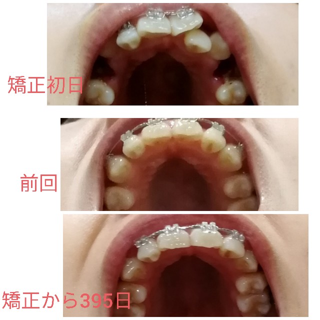f:id:miichanmama5:20191020164404j:image f:id:miichanmama5:20191020164404j:image