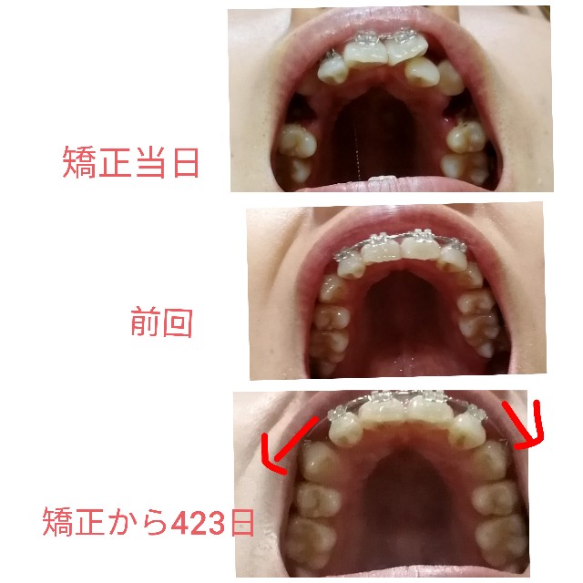 f:id:miichanmama5:20191117170451j:image f:id:miichanmama5:20191117170451j:image