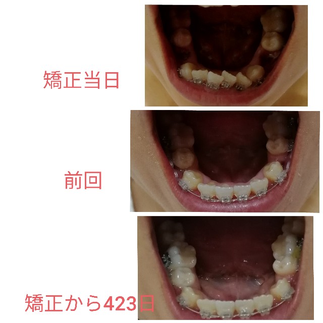 f:id:miichanmama5:20191117170526j:image f:id:miichanmama5:20191117170526j:image