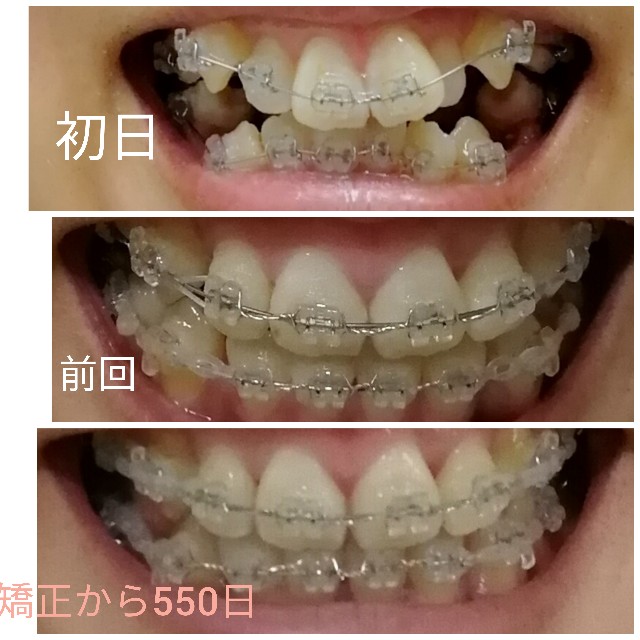 f:id:miichanmama5:20200411092154j:image f:id:miichanmama5:20200411092154j:image
