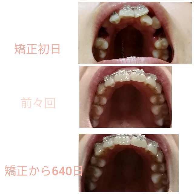 f:id:miichanmama5:20200622133558j:image f:id:miichanmama5:20200622133558j:image