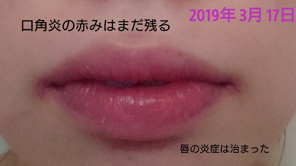 f:id:miityo_51:20190317212332j:plain