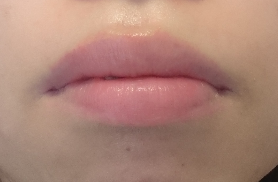 口角　コンシーラー