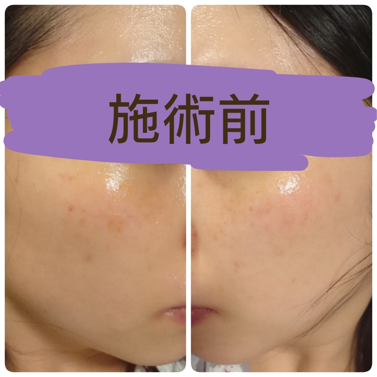 f:id:miityo_51:20190523093405j:plain f:id:miityo_51:20190523093405j:plain