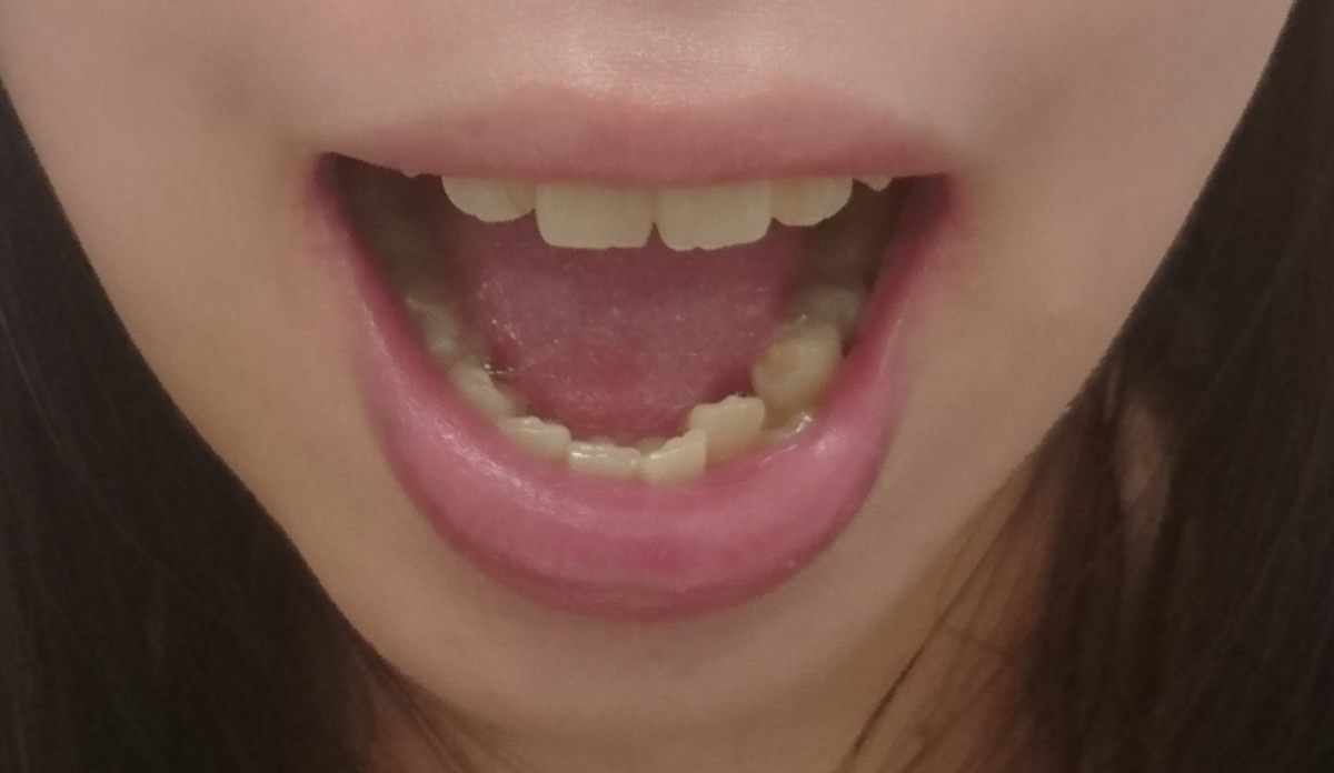 f:id:miityo_51:20190918141429j:plain
