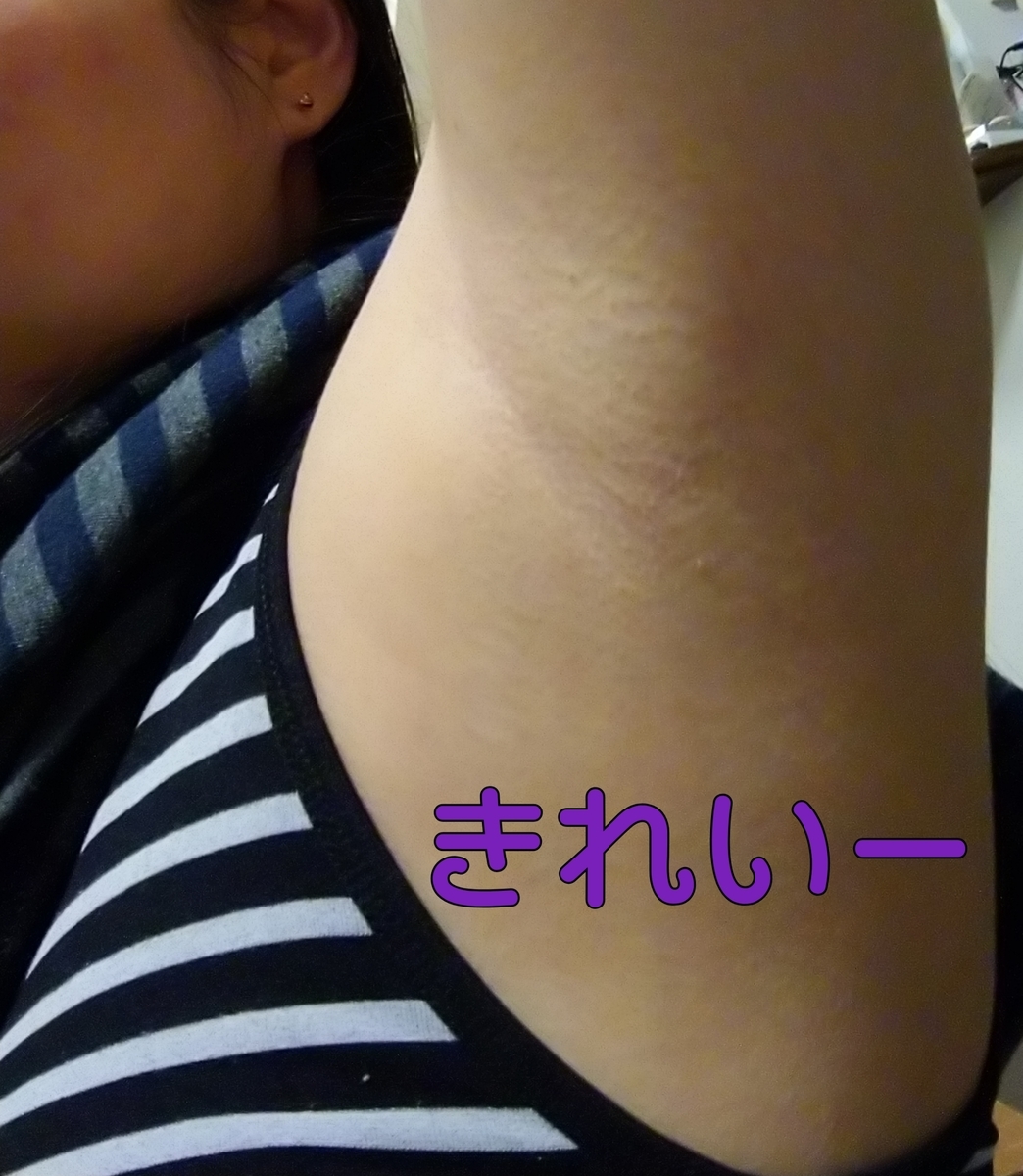 f:id:miityo_51:20200123094356j:plain