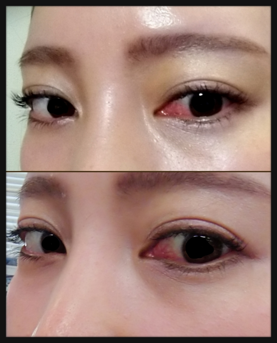 f:id:miityo_51:20200327092154j:plain