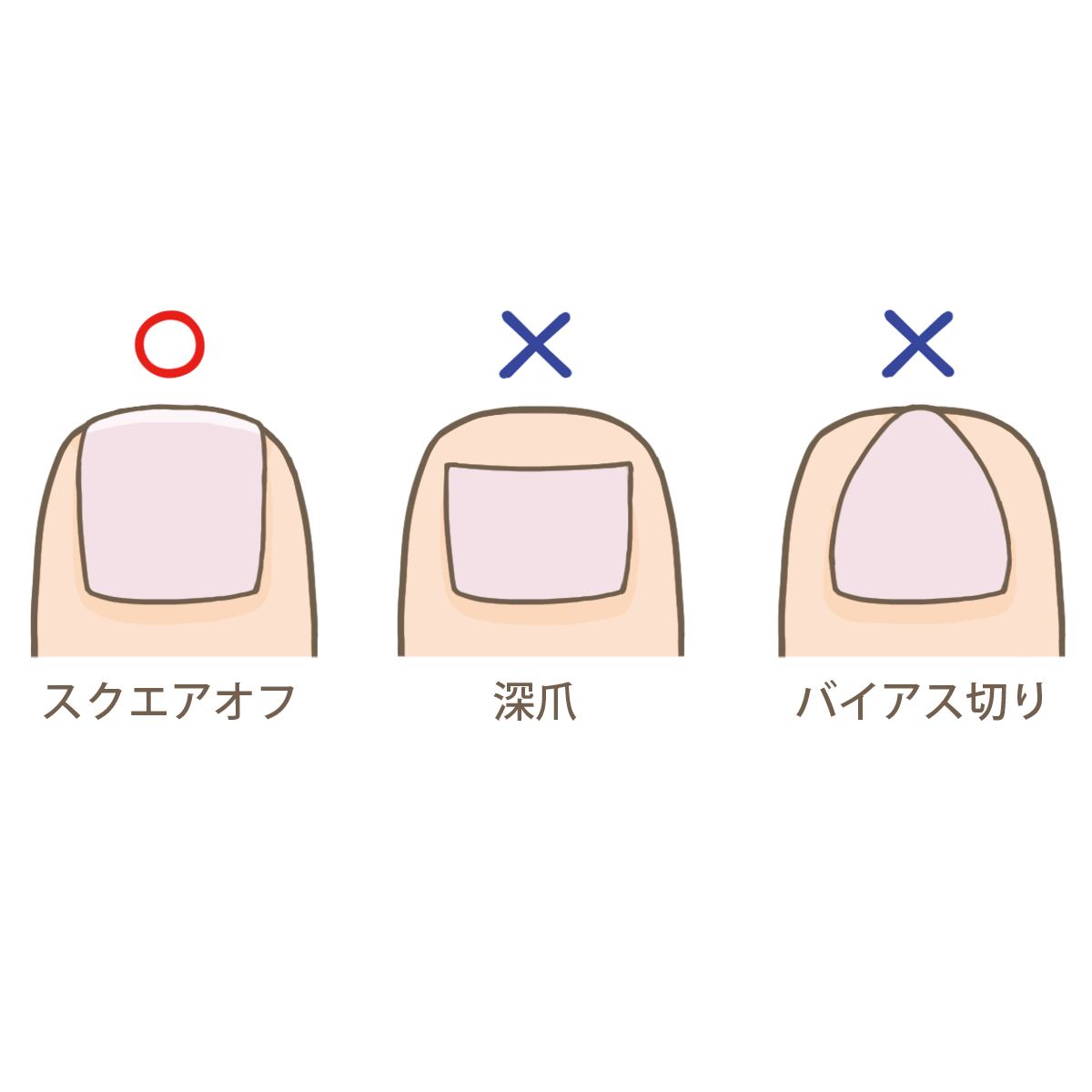 意外と知らない正しい爪の切り方 巻き爪対策 予防 みき訪問看護ステーション太鼓判ブログ