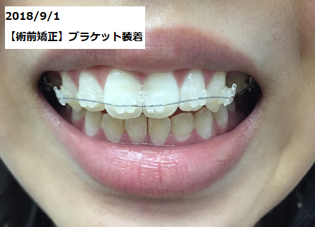 f:id:mikagex:20181208215846p:plain f:id:mikagex:20181208215846p:plain
