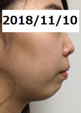 f:id:mikagex:20181208222436p:plain f:id:mikagex:20181208222436p:plain
