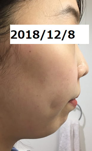 f:id:mikagex:20181208222444p:plain f:id:mikagex:20181208222444p:plain