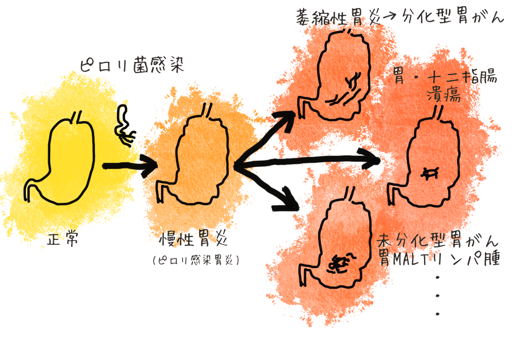 f:id:mikanusagi:20220920204536p:image f:id:mikanusagi:20220920204536p:image