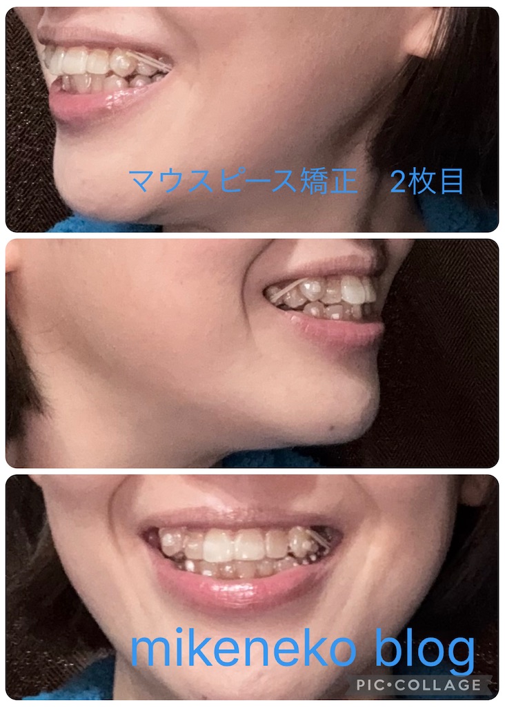 f:id:mikenekoblog123:20260311081307j:image