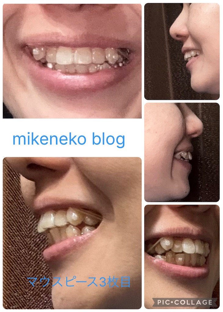 f:id:mikenekoblog123:20260318085707j:image