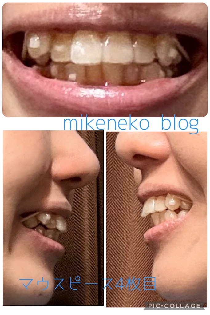 f:id:mikenekoblog123:20260325082937j:image