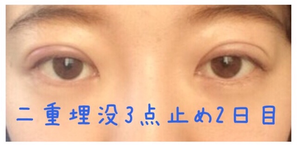 f:id:milfychan:20170721211658j:image