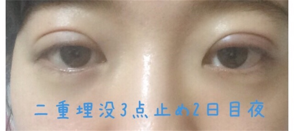 f:id:milfychan:20170721211932j:image