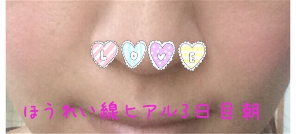 f:id:milfychan:20170731110850j:image