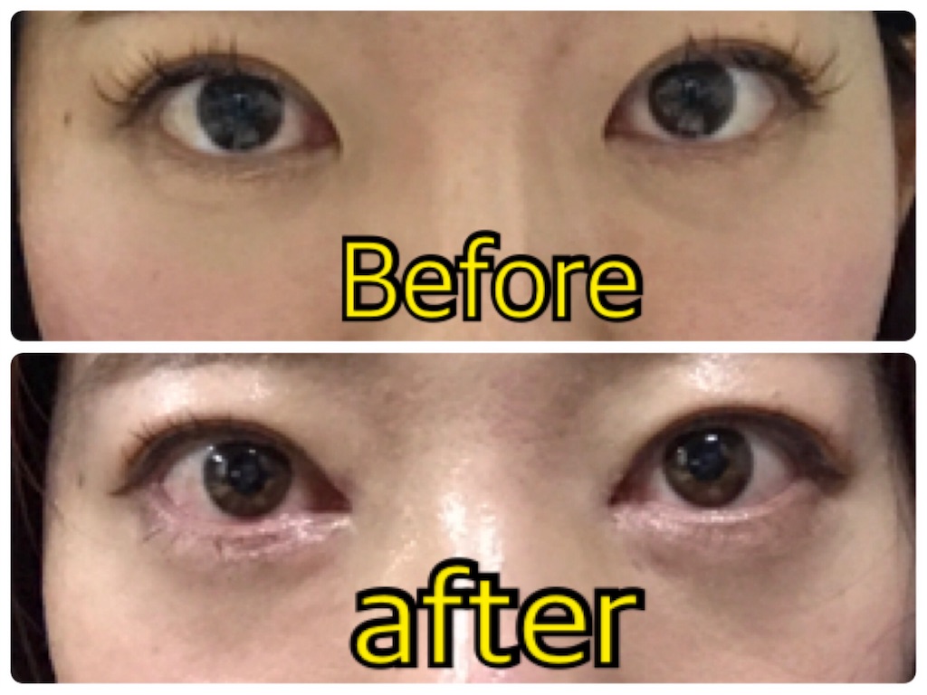 f:id:milfychan:20171216111023j:image