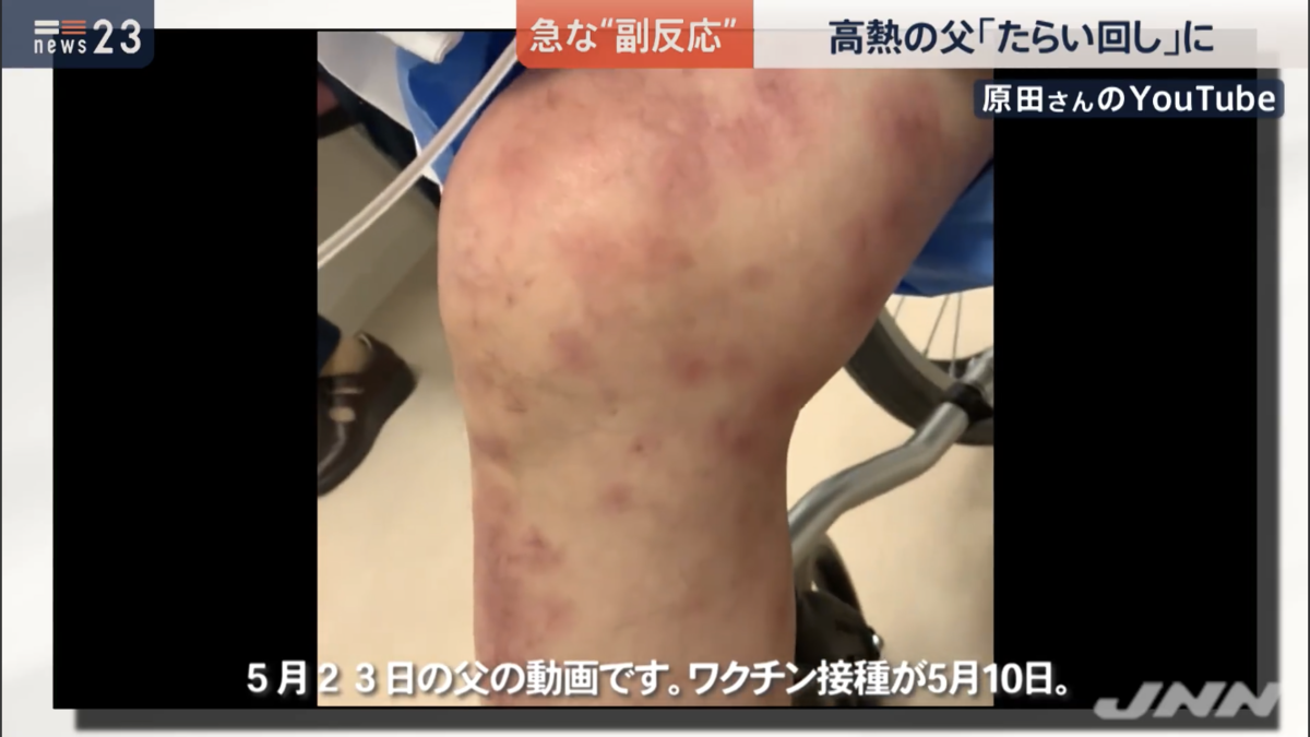 f:id:min117:20210920061344p:plain