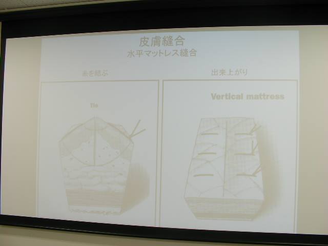 f:id:minamiedu2016:20180521081927j:plain