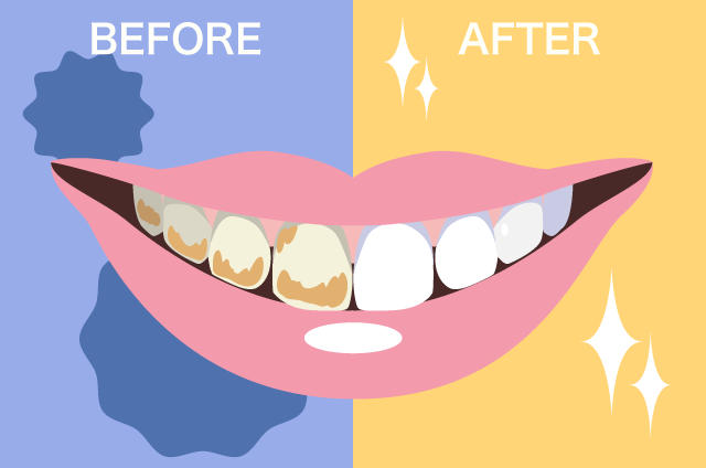 f:id:minaraisennin:20170213115054p:plain