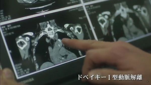 f:id:minaraisennin:20170220010846j:plain