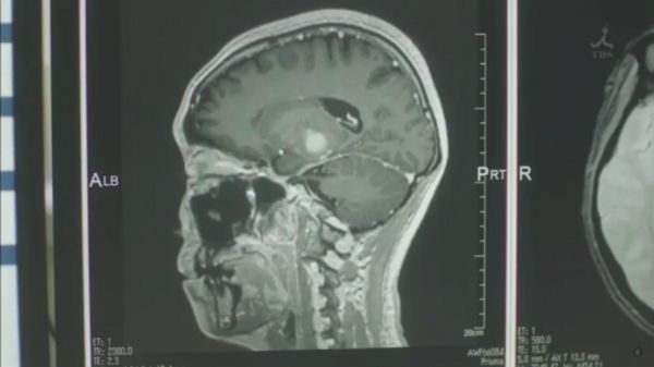 f:id:minaraisennin:20170220011114j:plain