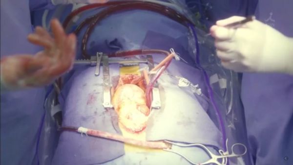 f:id:minaraisennin:20170220011436j:plain