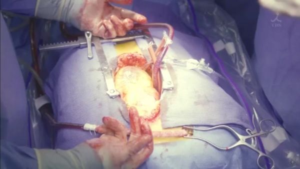 f:id:minaraisennin:20170220011509j:plain