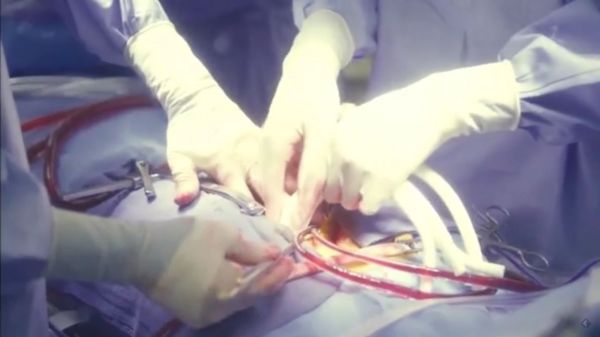 f:id:minaraisennin:20170220011634j:plain