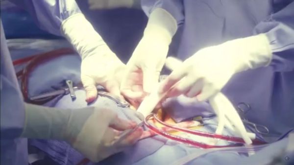 f:id:minaraisennin:20170220011635j:plain