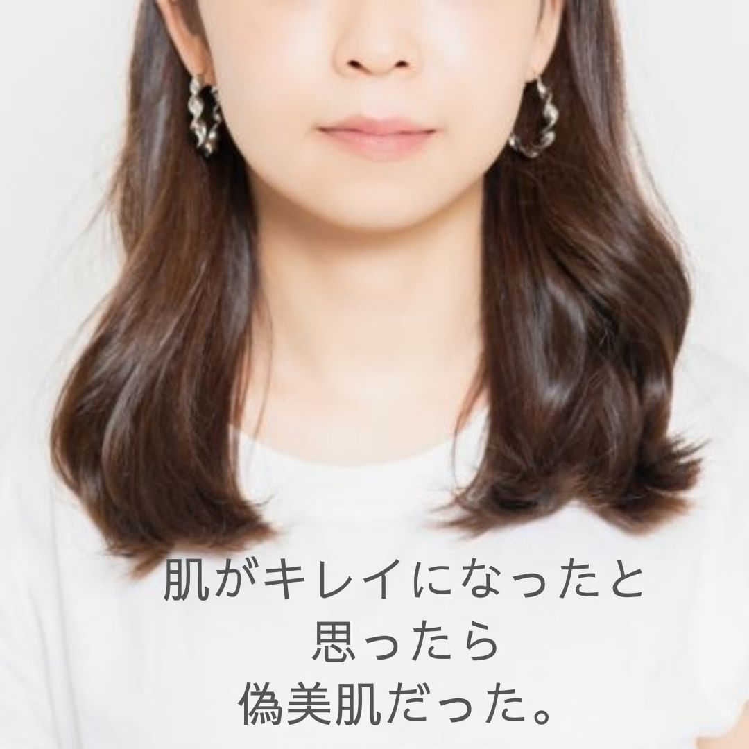 肌がキレイになったと思ったら偽美肌だった ゆるゆるみにまり