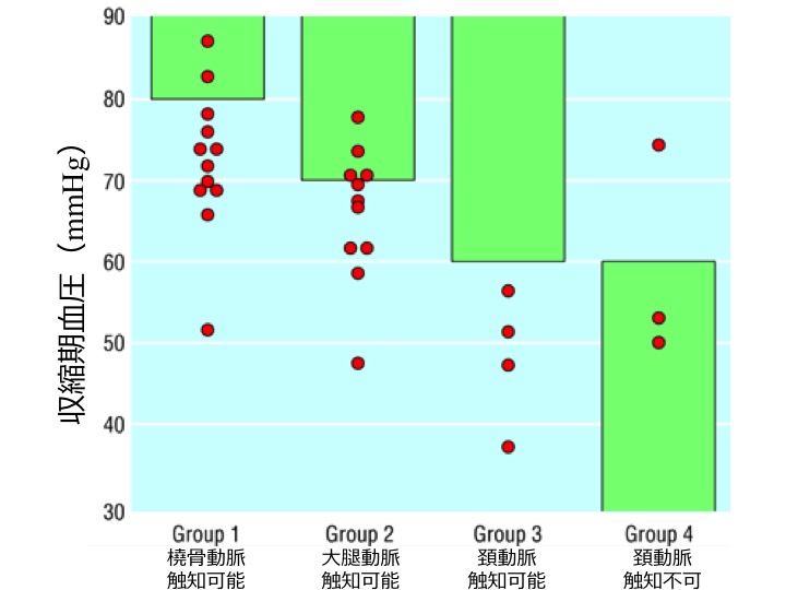 f:id:minimalzuh:20210315230140j:plain