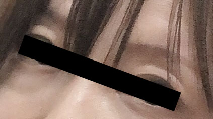 アトピーと眼精疲労による老けEYE飛びつく】ついに発売