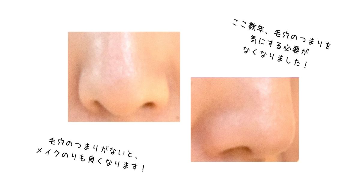鼻の毛穴のアップ