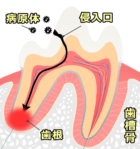 f:id:minvet2007:20160112173317p:image
