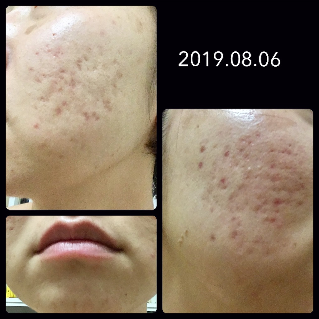 f:id:minykun:20210128202909j:image f:id:minykun:20210128202909j:image