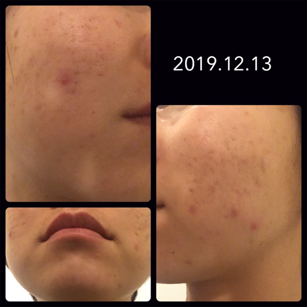 f:id:minykun:20210204080510j:image f:id:minykun:20210204080510j:image