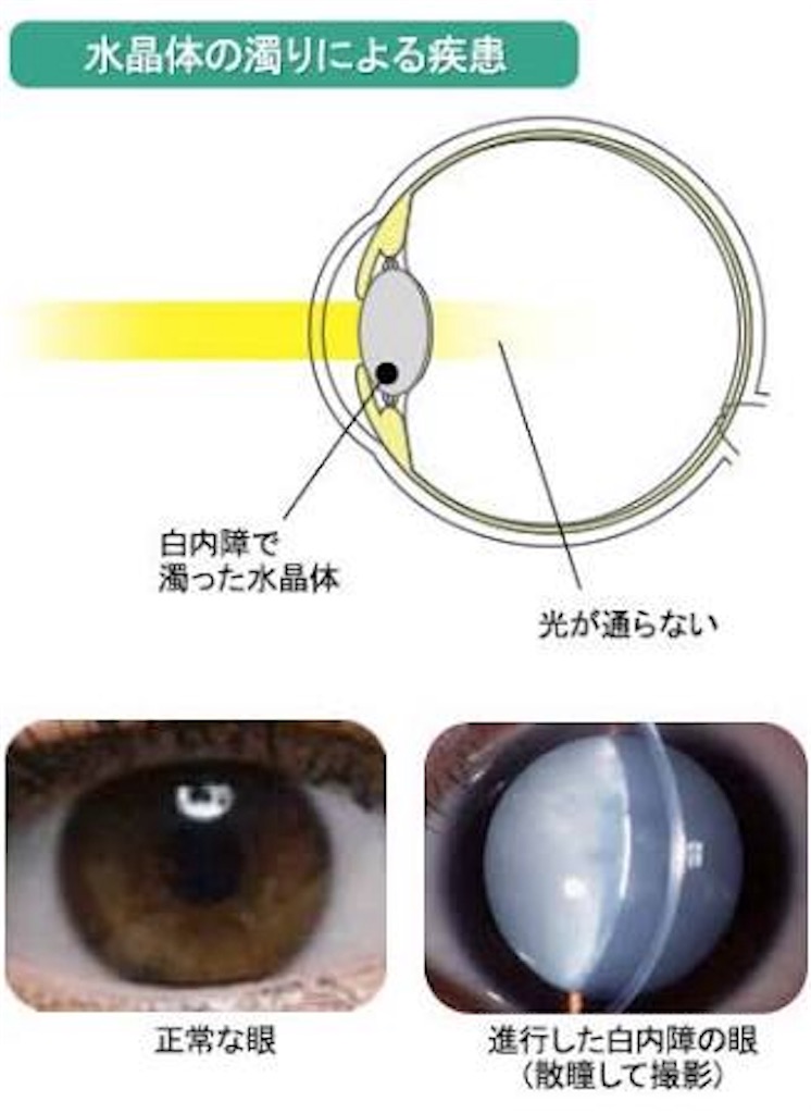 f:id:miraclemiraclemiraclemiracle3:20190320122410j:image