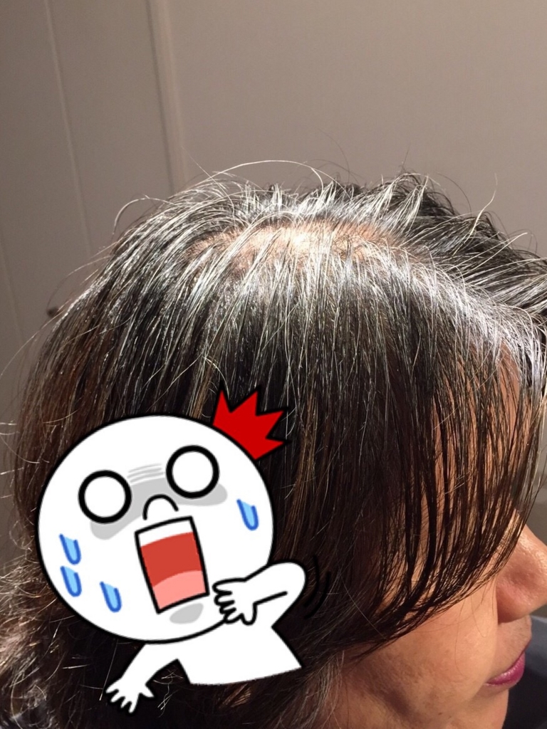 f:id:misakikohama:20151031222718j:plain f:id:misakikohama:20151031222718j:plain