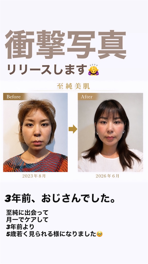 f:id:misakikohama:20260616062621j:image