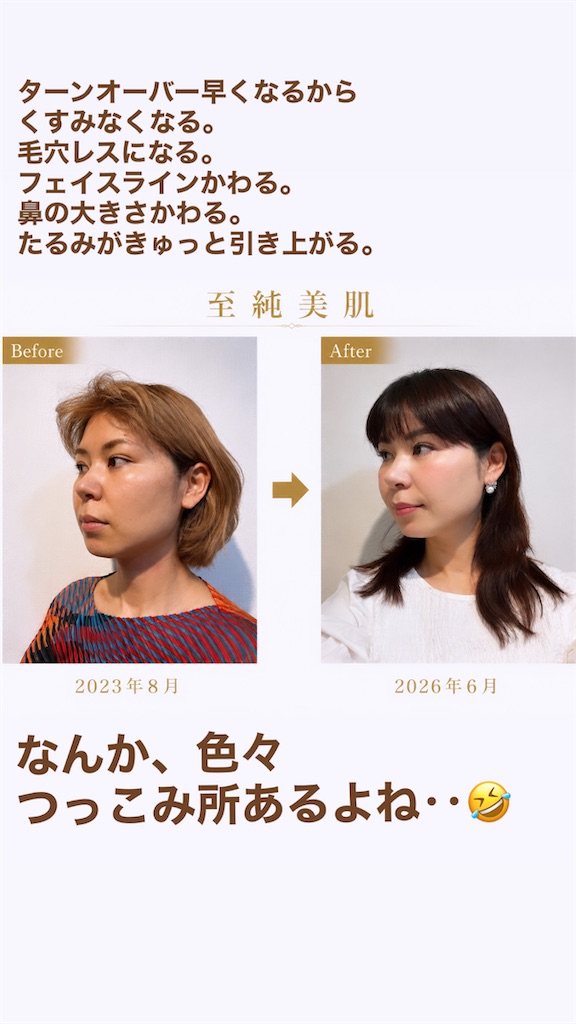 f:id:misakikohama:20260616062626j:image