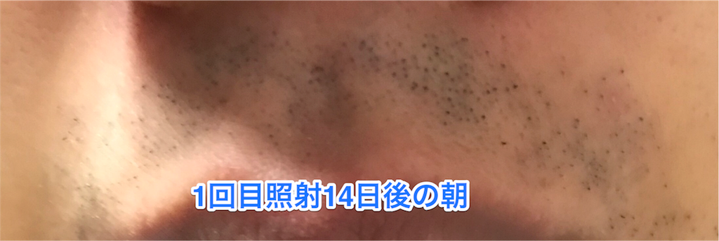 f:id:misojigatoru:20170927181354p:image f:id:misojigatoru:20170927181354p:image
