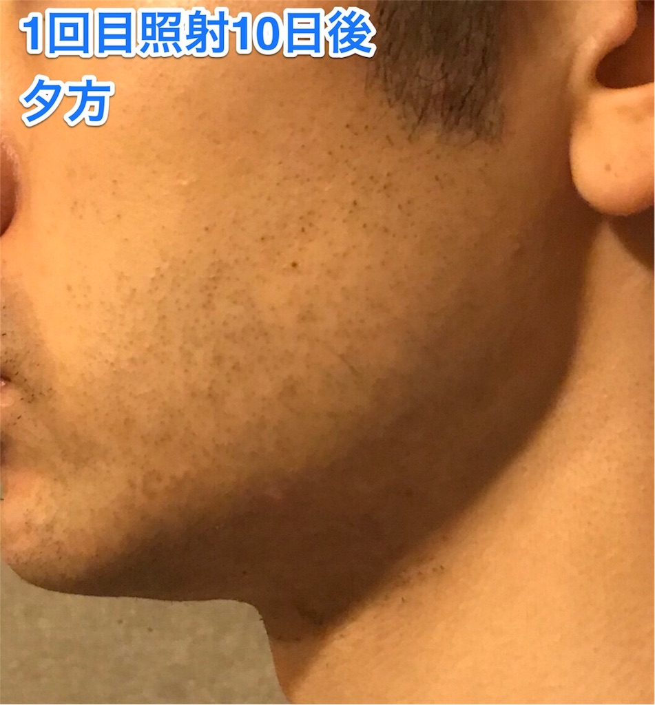 f:id:misojigatoru:20170927181445j:image f:id:misojigatoru:20170927181445j:image