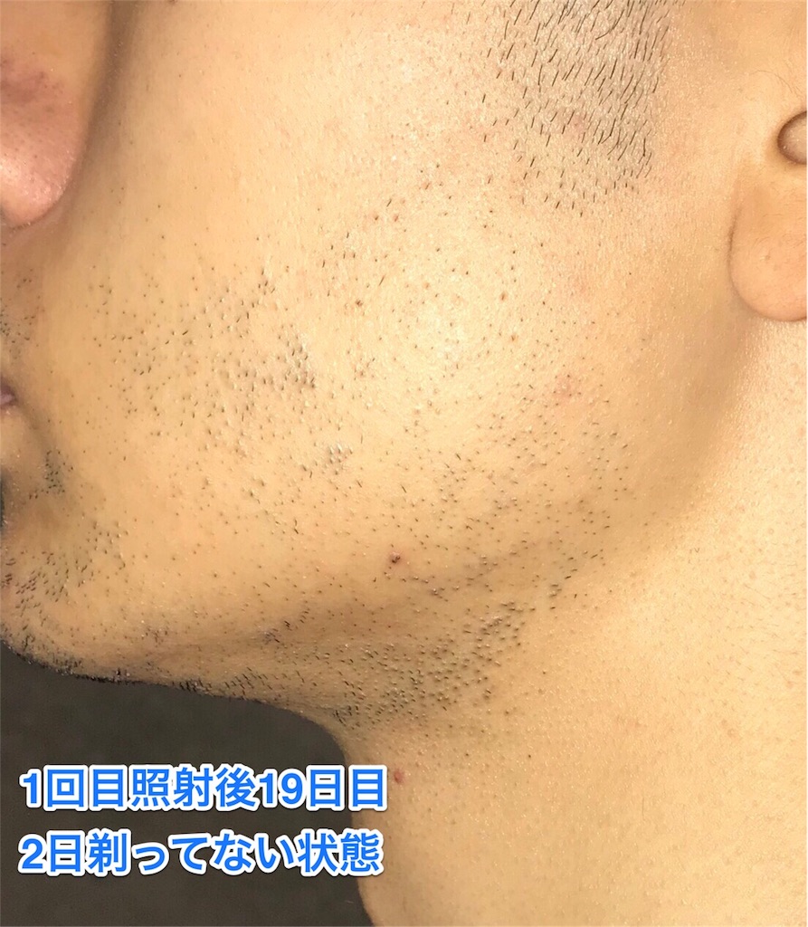 f:id:misojigatoru:20171009145233j:image f:id:misojigatoru:20171009145233j:image