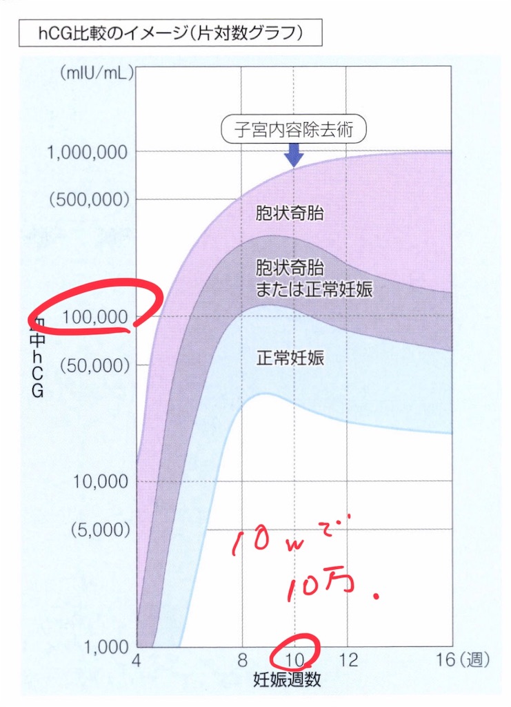 胞状 奇 胎 ブログ