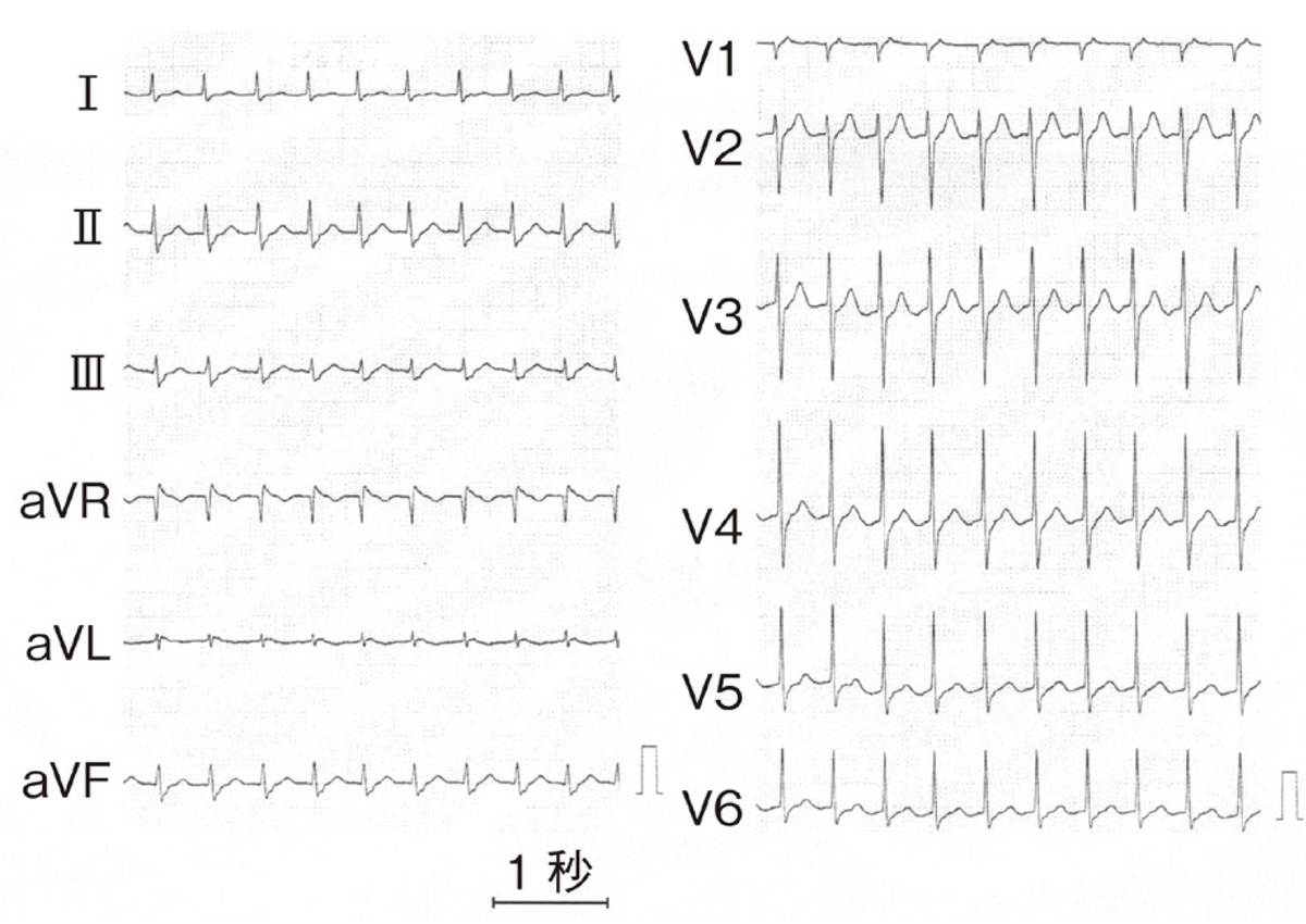 f:id:misoramenn:20190928225357j:plain